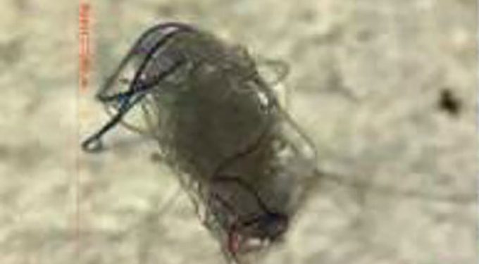 Mikroplastik