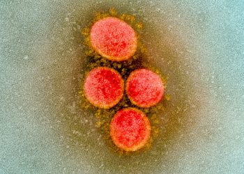 Virus Corona SARS-COV-2. FOTO: NIAID.NIH.GOV