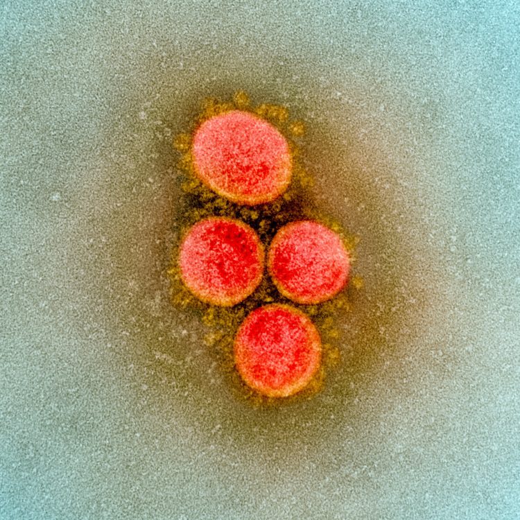 Virus Corona SARS-COV-2. FOTO: NIAID.NIH.GOV