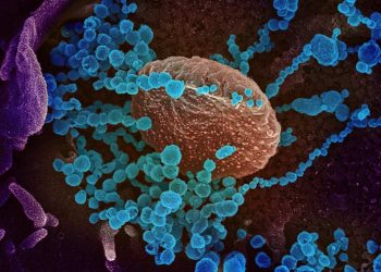 Diagnosis dan Pencegahan Infeksi Virus Corona