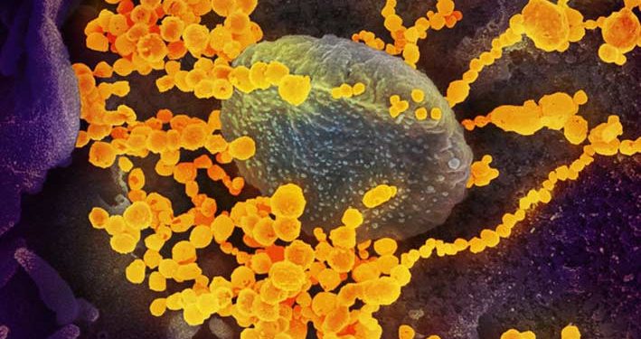 Tak Semua yang Positif Covid-19 Harus Dirawat di Rumah Sakit