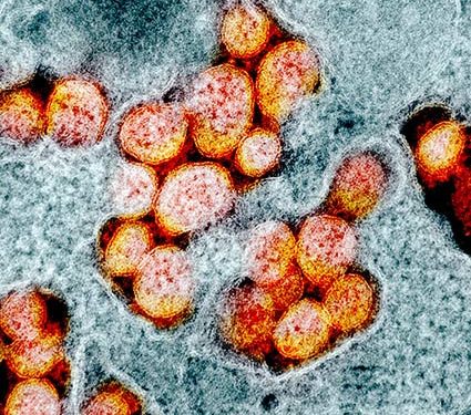 Setengah Juta Lebih Orang di Amerika Serikat Terinfeksi Covid-19