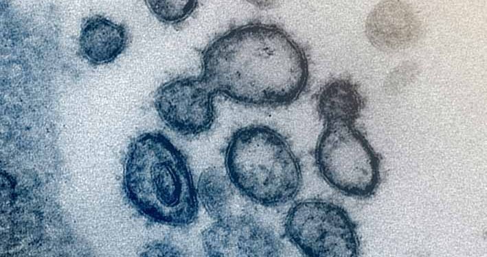 Pengadaan Obat Covid-19, Indonesia Kerjasama dengan Jepang dan India