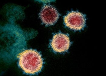 Virus Corona, 70 Laboratorium di Indonesia Diaktifkan untuk Pemeriksaan PCR