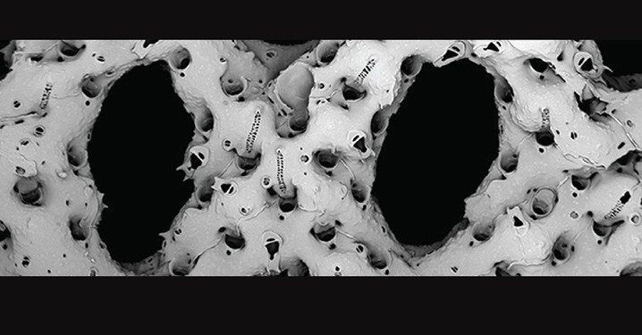 Bryozoa Spesies Baru Ditemukan Mahasiswa FPIK Undip di Perairan Jepara