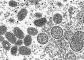 Virus yang terbentuk secara penuh dan sudah dewasa, virion monkeypox. GAMBAR: Cynthia S. Goldsmith, Russell Regner/CDC/AP/Accuweather.com