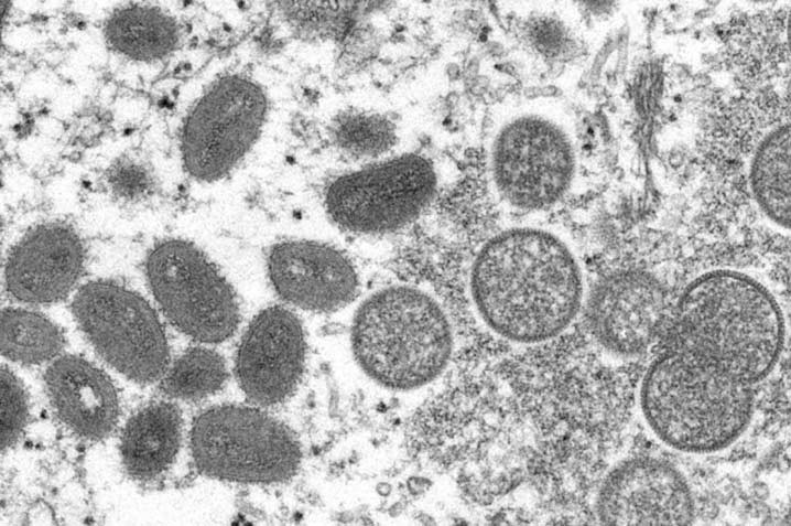 Virus yang terbentuk secara penuh dan sudah dewasa, virion monkeypox. GAMBAR: Cynthia S. Goldsmith, Russell Regner/CDC/AP/Accuweather.com