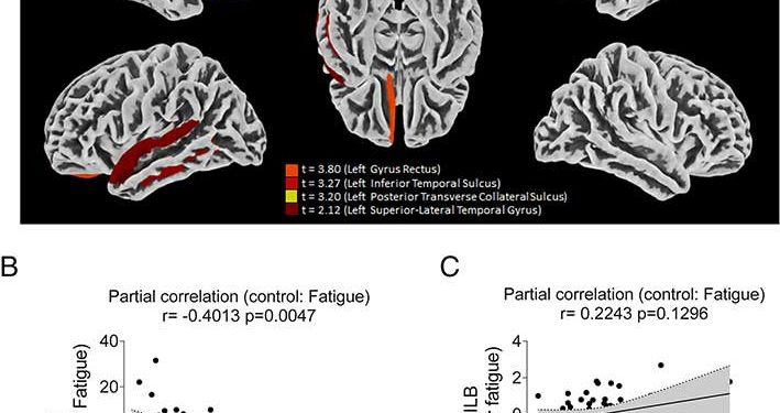 Ini Bukti Virus SARS-CoV-2 Menginfeksi Sel Astrosit di Otak