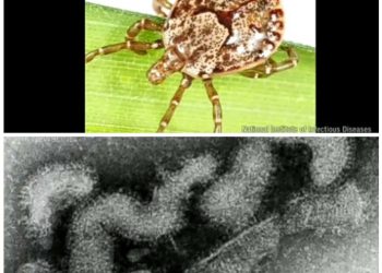 Pertama di Dunia Virus Oz yang Ditularkan Kutu Membawa Kematian di Jepang