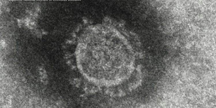 Kasus Virus Corona Terus Meningkat di Seluruh Jepang