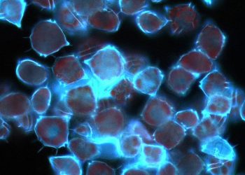 Plankton Lenyap, Kehidupan di Daratan Tak Akan Bertahan Lama