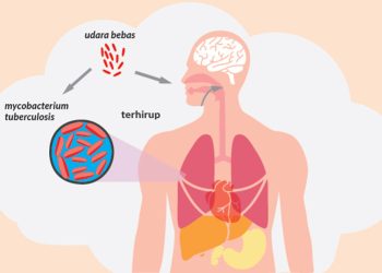 6.949 Kasus Tuberkulosis di Gorontalo, Tempati Peringkat 15 Nasional