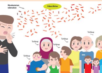 Lebih Dari 3300 Orang Meninggal Karena Tuberkulosis Setiap Hari