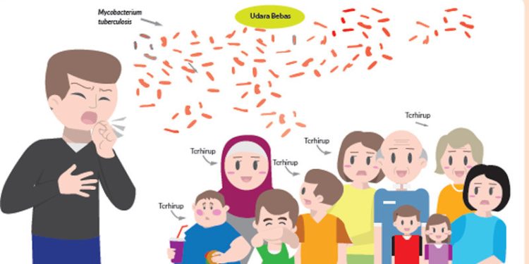 Lebih Dari 3300 Orang Meninggal Karena Tuberkulosis Setiap Hari