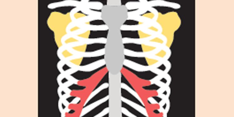 WHO Menyerukan Tindakan Mendesak Mengakhiri Tuberkulosis